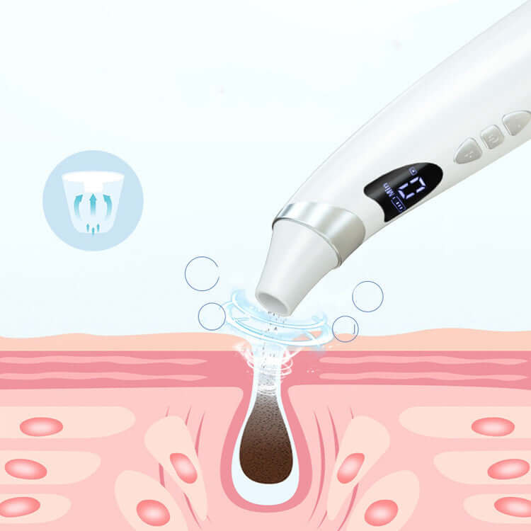 Electric Visual Blackhead Suction Cleansing Pore Cleaner Care Tool